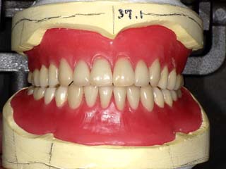 人工歯配列正面